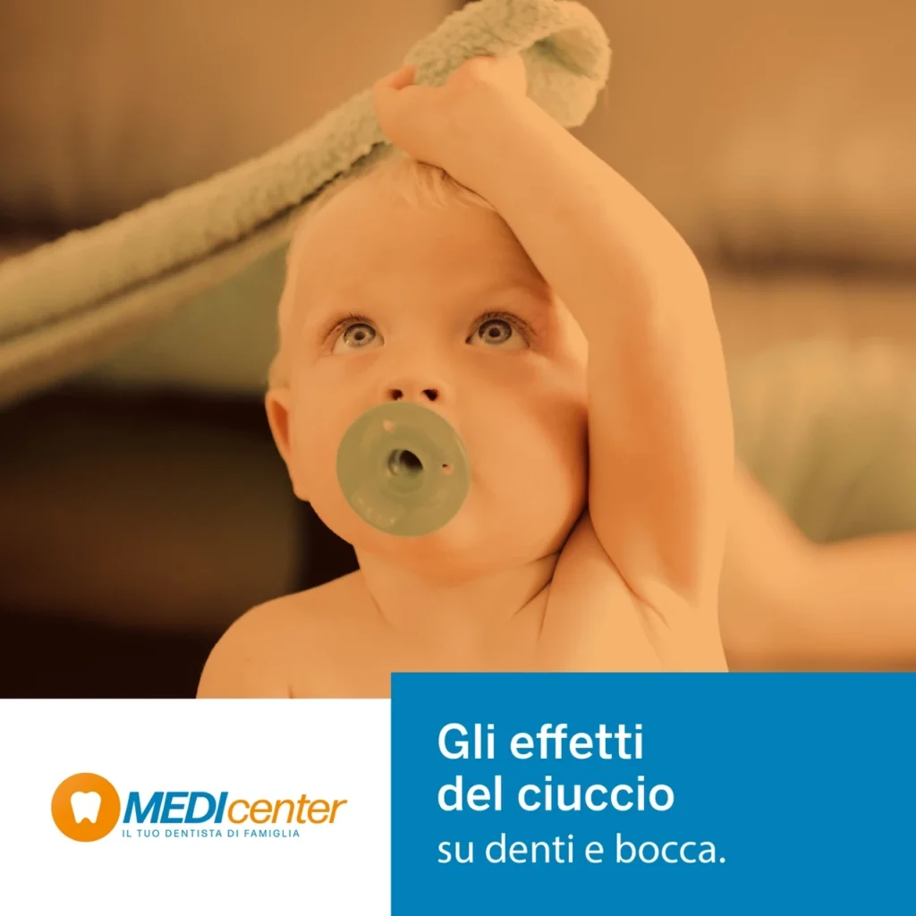 Gli effetti del ciuccio su denti e bocca