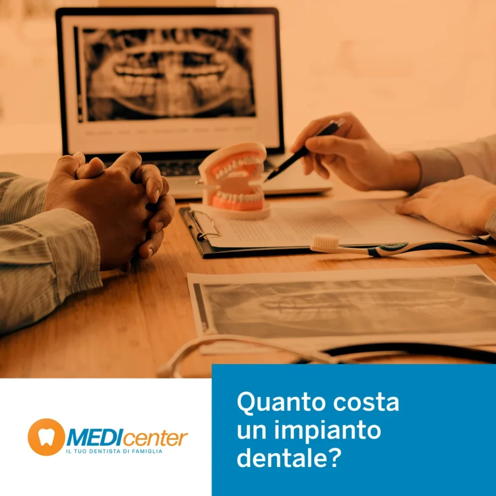 Quanto costa un impianto dentale?