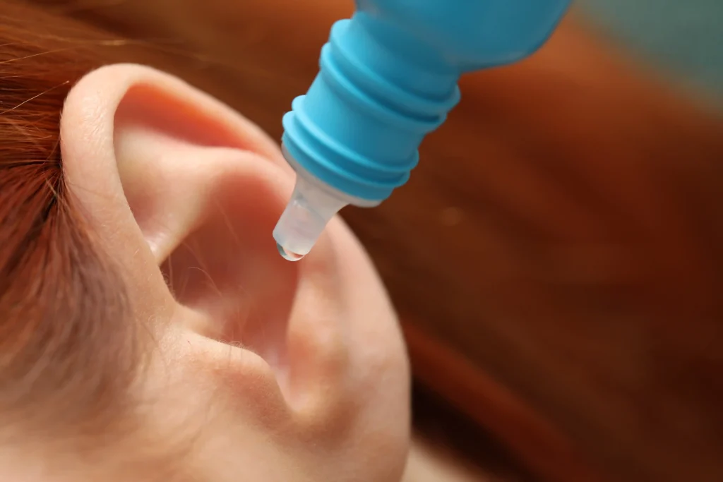 Tappo di cerume: come riconoscerlo e perché non usare i bastoncini di cotone 2 Tappo di cerume