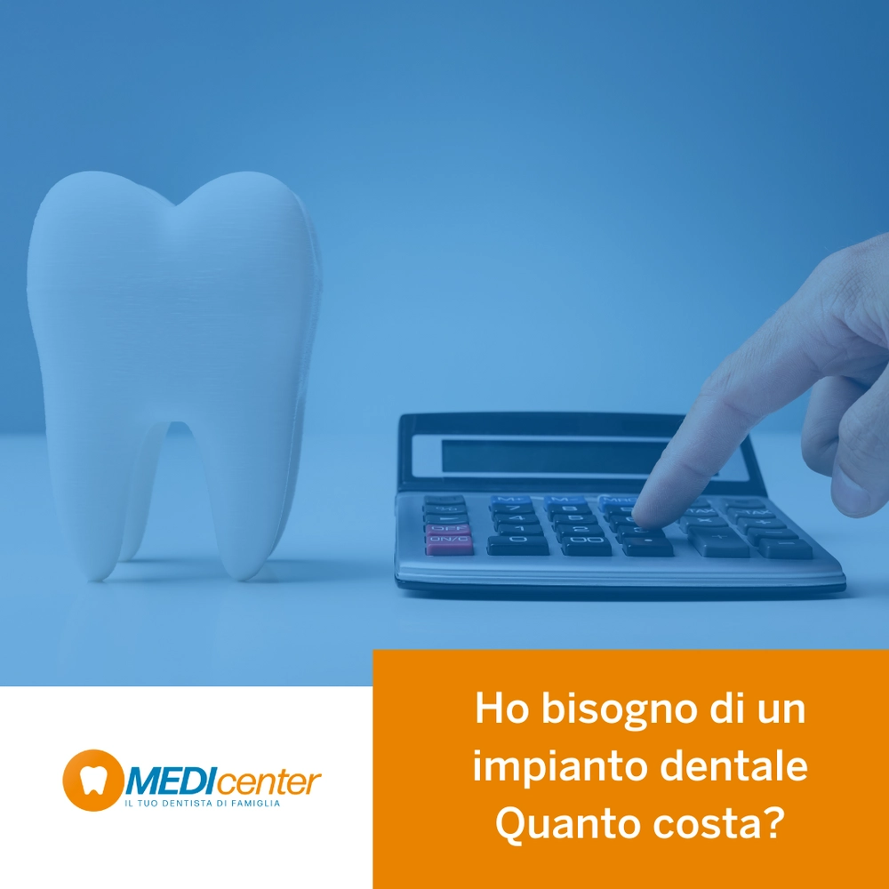 Ho bisogno di un impianto dentale, quanto costa?